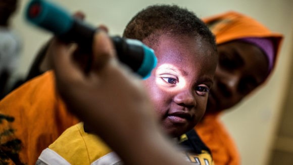 Trachoma diagnosis